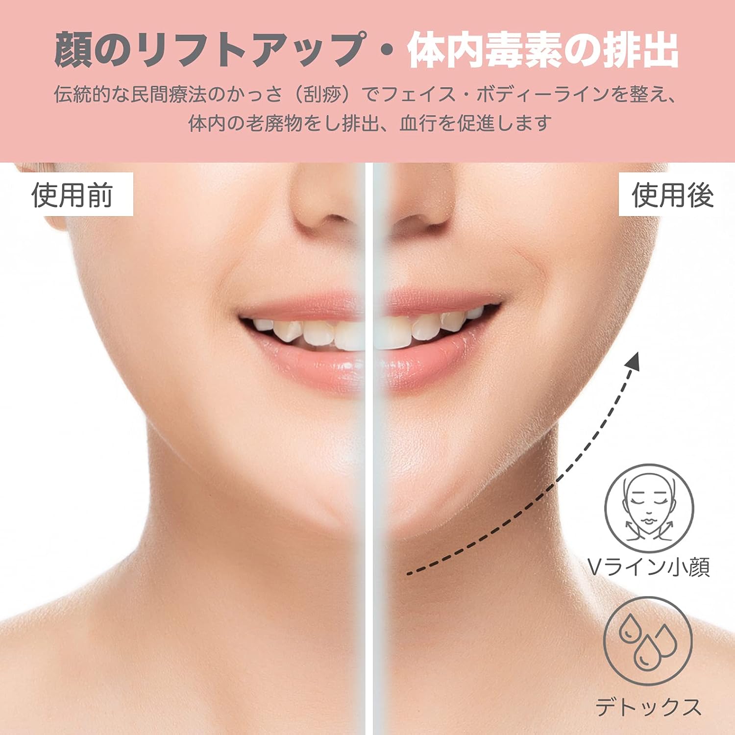 Amazon Emay Plusかっさプレート カッサ板 かっさ 刮痧 美顔器 美容 小顔 3モード 多機能 温熱ケア 振動 赤色led スキンケア 引き上げ 顔 ボディーケア ワンボタン 保護カバー付き 軽量 コンパクト 美容グッズ ピンク 406 Emay Plus かっさプレート 通販