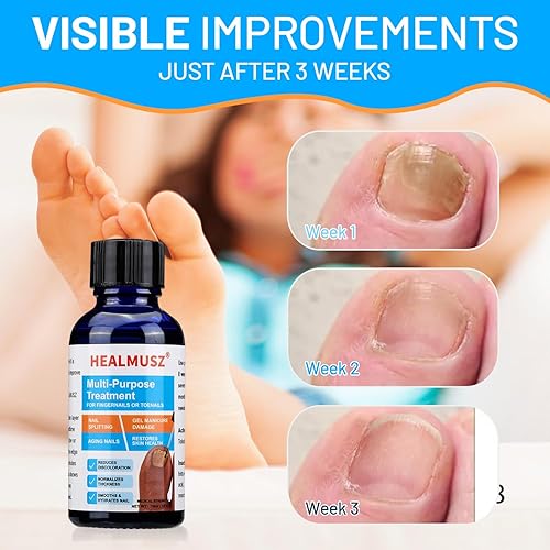 Miniatura 5 de Tratamiento de hongos en las uñas de los pies extra fuerte, tratamiento de hongos en las uñas de los pies, tratamiento de pies de atletas,