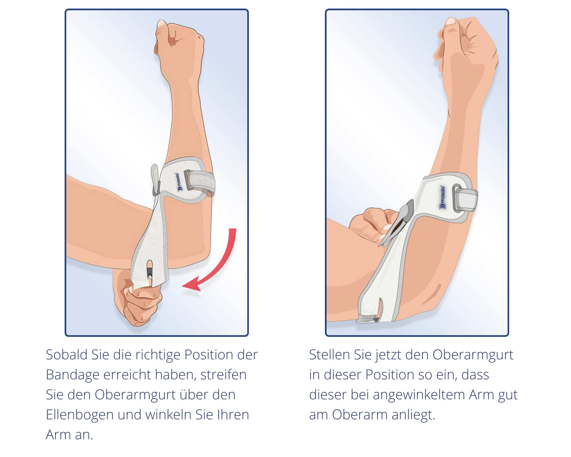 Masalo® Manschette MED - bei Tennisarm, Golferarm, Mausarm (Epicondylitis) (Größe 2 / rechter Arm)