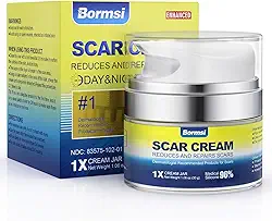 Creme para cicatrizes, gel ativo de silicone dimeticona para cicatrizes antigas para cicatrizes cirúrgicas, estrias, queimaduras, queloides, tratamento para acne, 30 g