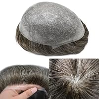Vista 41 de Toupee - Sistema de reemplazo de piezas de cabello humano real, piel ultrafina, para hombres, cabello indetectable, línea capilar natural