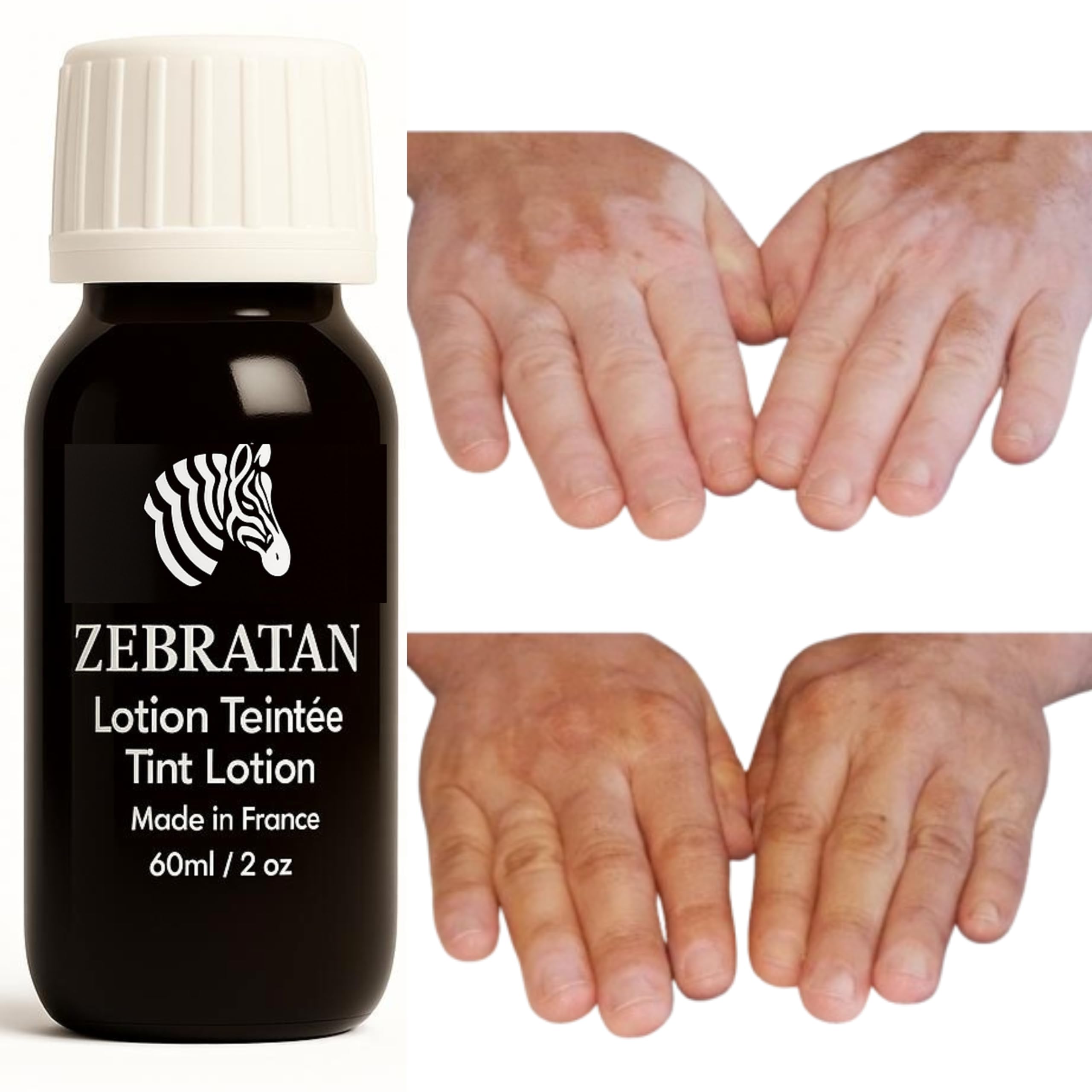 Lotion Maquillage Vitiligo 60 ml – Masque les Taches Blanches sur la Peau – Camouflage Naturel Non Gras pas un fond de teint – Hommes, Femmes & Enfants – Autobronzant, Vegan – Teinte beige clair