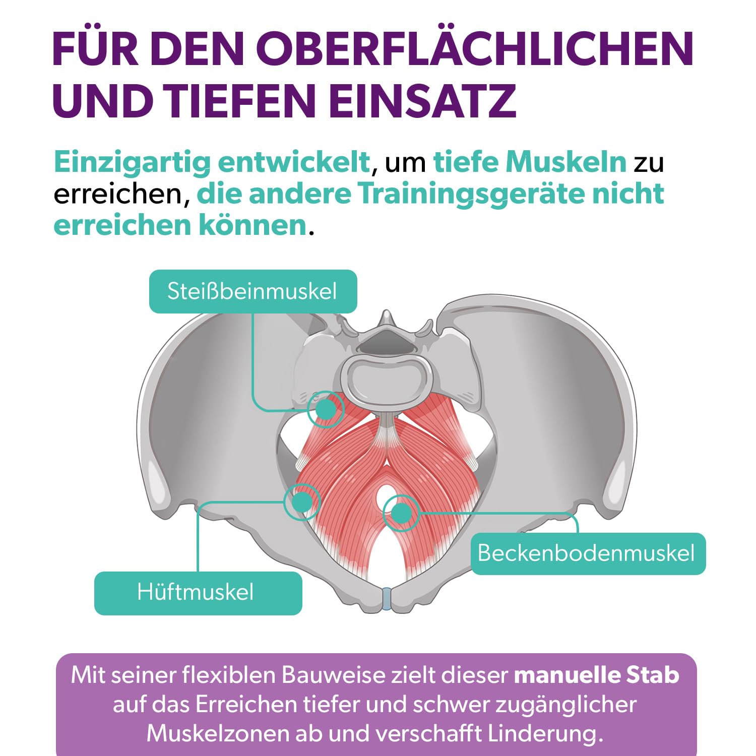 IntimateRose Beckenstab für Trigger- & Tenderpunkte der Beckenbodenmuskulatur - Männer & Frauen – Anwendbar für Beckenbodenphysiotherapie