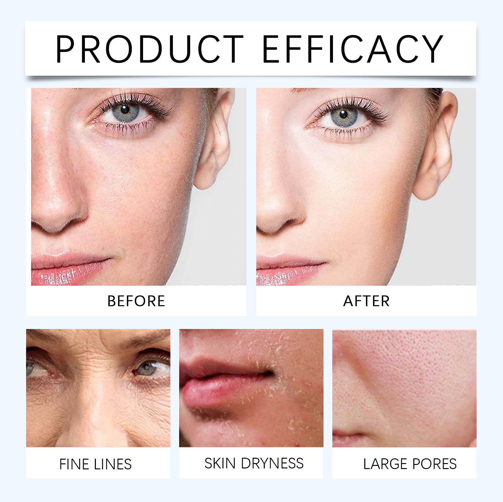30 sztuk sterylnych ampułek z kwasem hialuronowym, 1,2 ml, 3% serum 4D HA do twarzy, nawilżający krem nawilżający do suchej i wrażliwej skóry, serum starzeniowe z kolagenem (5 pudełek)