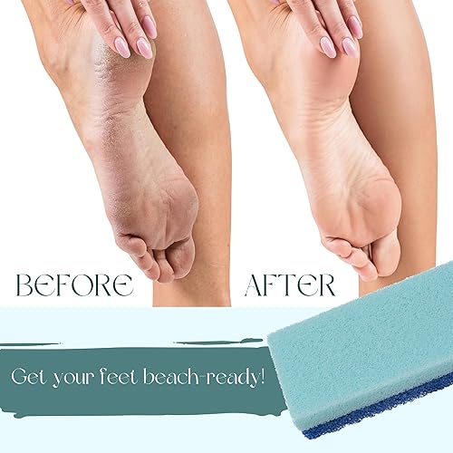 Miniatura 5 de Mantello Piedra pómez para pies, depuradores de pies para ducha y bañera de pies, piedra pómez para eliminar callos de pies, limpiador de pies de