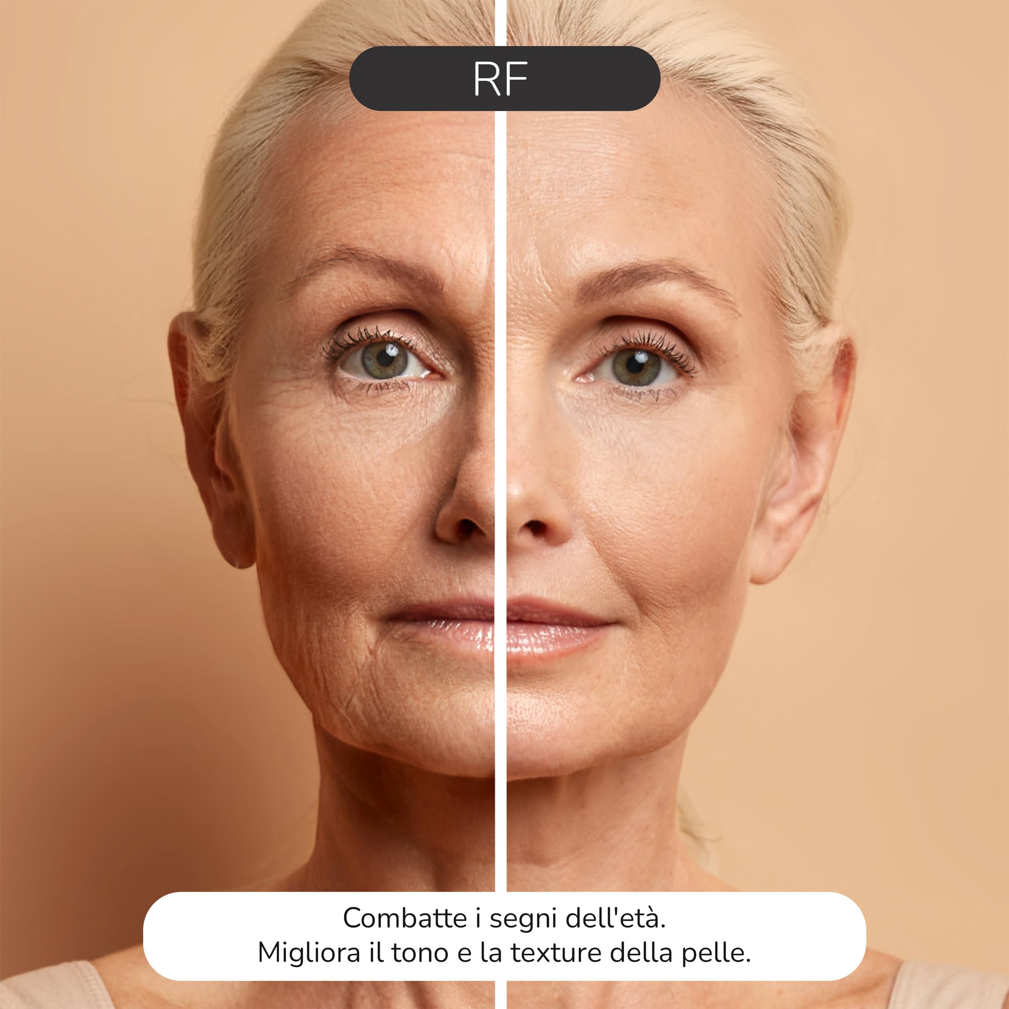 Illume 2nd Gen Radiofrequenza viso et Massaggiatore Viso, Dispositivo antirughe con radiofrequenza viso professionale per Lifting Viso e Cura Anti-età