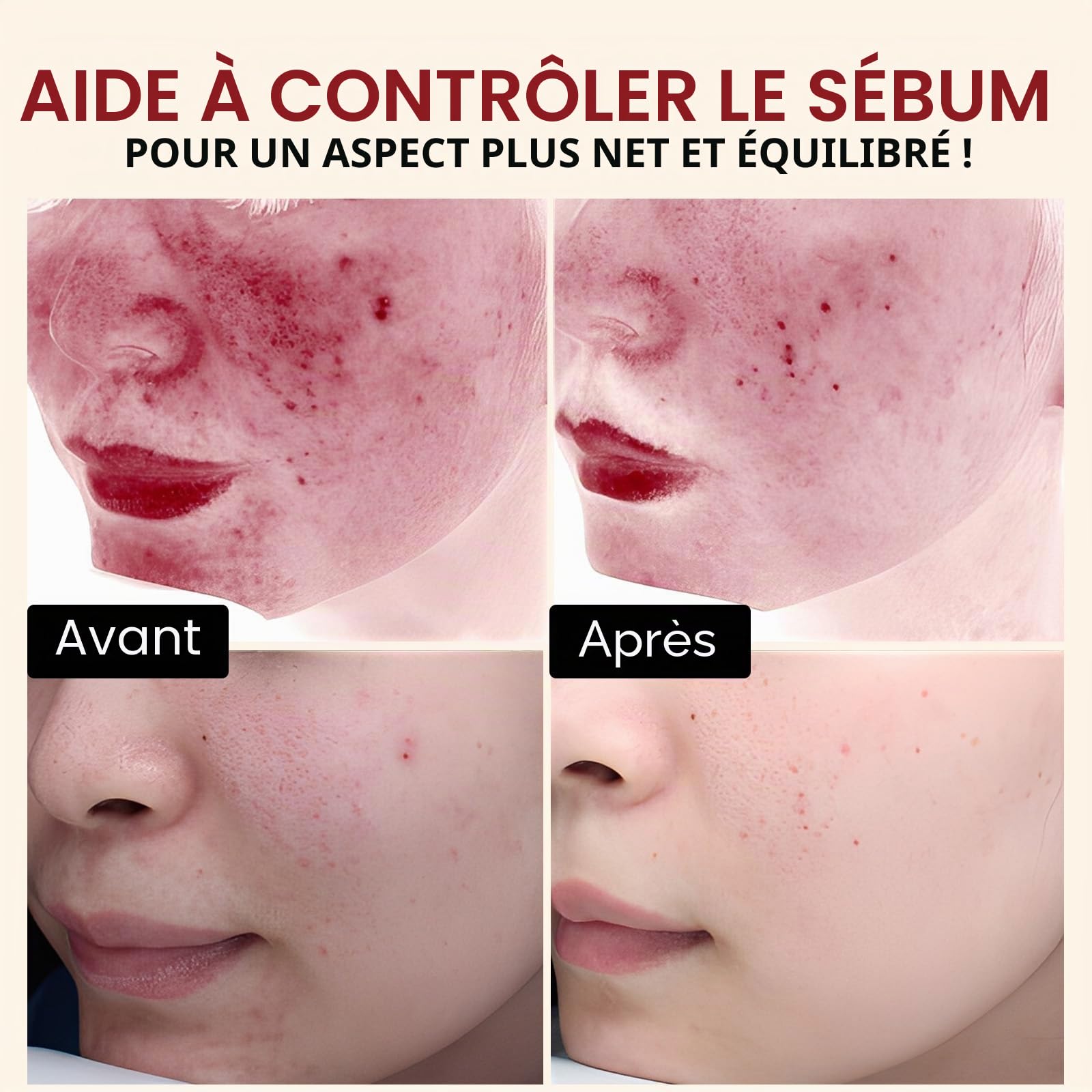 Sérum Exfoliant Coréen au Riz 100ml – Gommage Visage Doux, Élimine Peaux Mortes & Points Noirs, Réduit les Pores, Hydratant & Éclaircissant