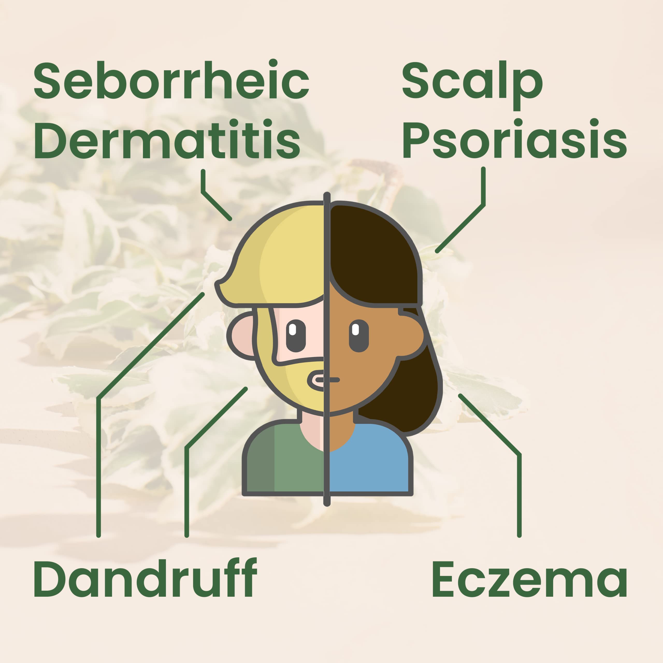 Balmonds Scalp & Beard Oil 50 millilitres Natural Treatment for Scalp