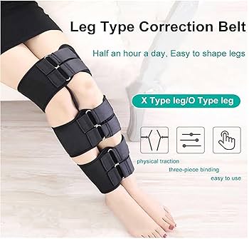 Amazon | X/O の形の足の矯正ベルト、調節可能な足の矯正ベルト