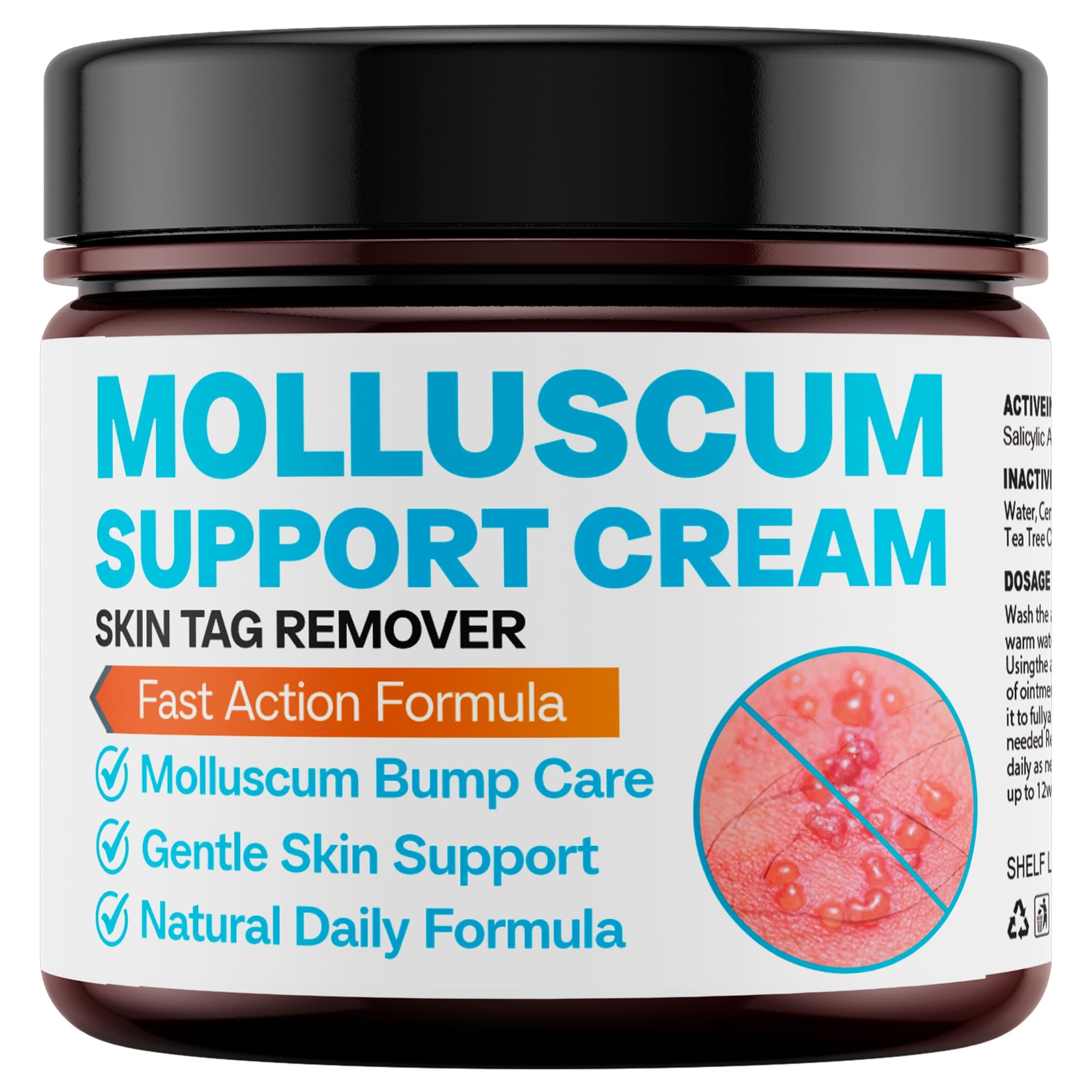 Molluscum Support Treatment Cream