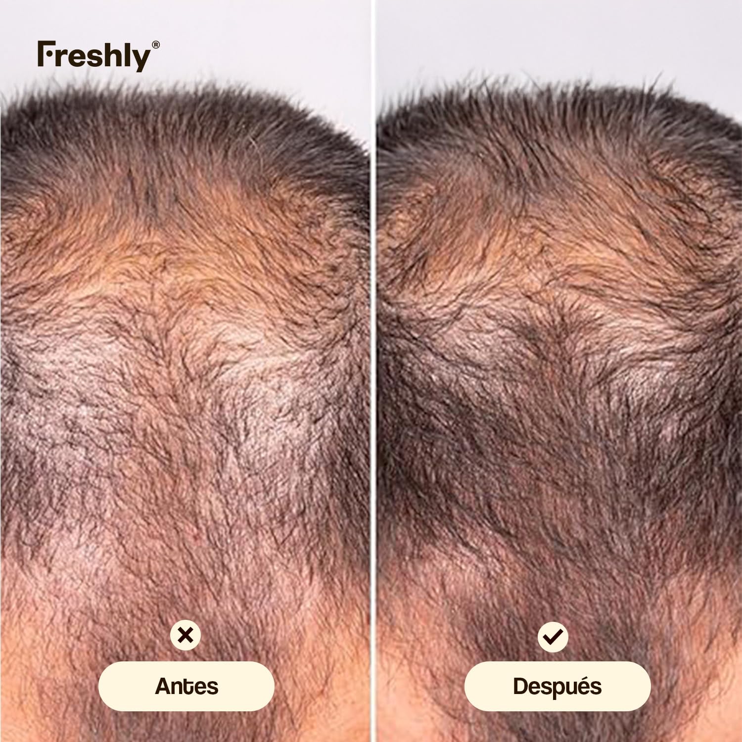 Freshly - Tratamiento Serum Capilar Anticaída del Pelo Hair Growth & Density Treatment - Fórmula 99,9% Natural - Para el Crecimiento y Densidad del Cabello - Pelo Fuerte y Saludable - 50 ml