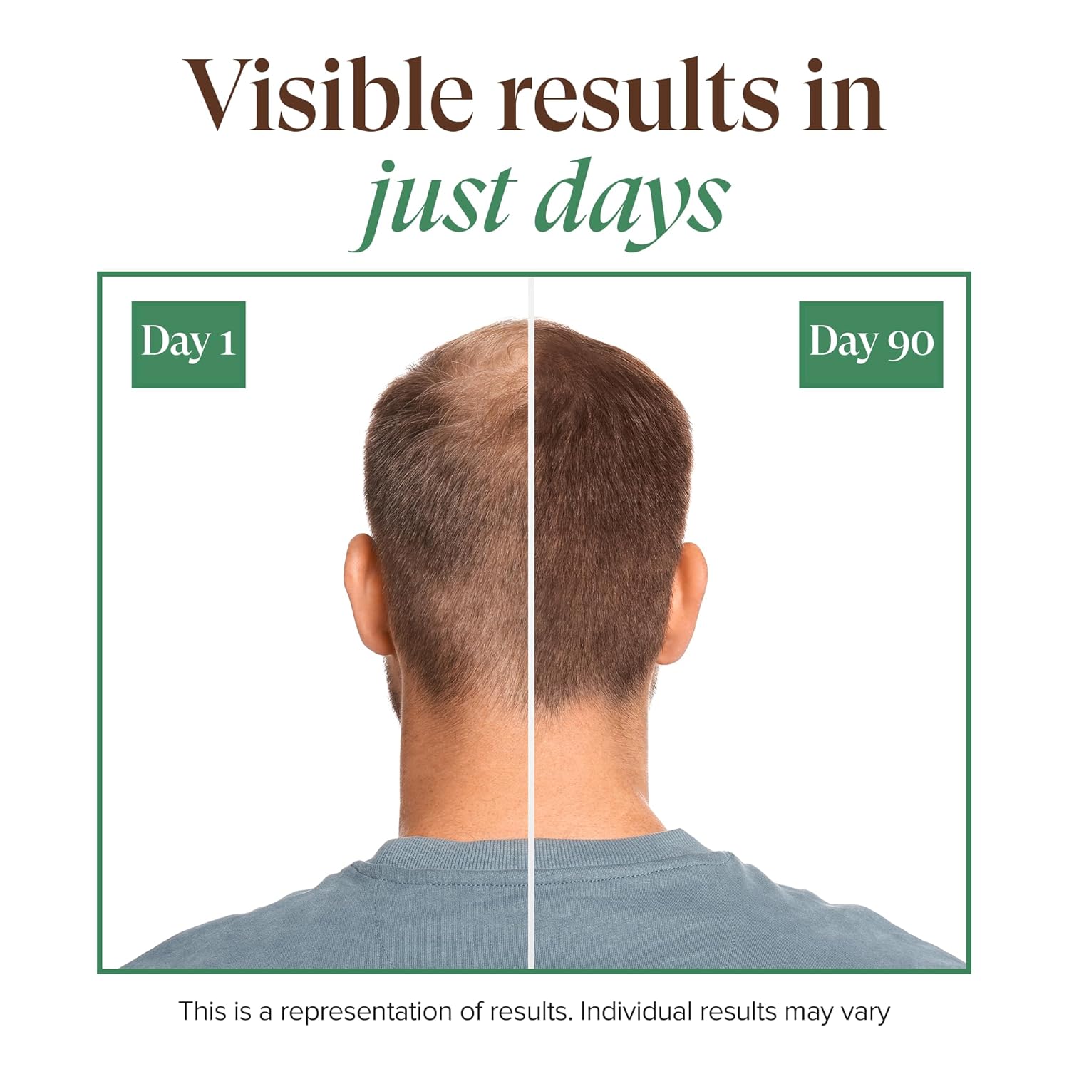 Kreyol Essence - Save Our Scalp Serum (S.O.S Serum) - Redensyl + Haitian Black Castor oil, Fuller Looking Hair, Cold Pressed Castor Oil, Natural Ingredients 1.7 oz