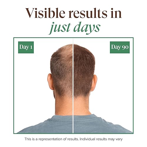 Miniatura 3 de Kreyol Essence - Save Our Scalp Serum (S.O.S Serum) - Redensyl + aceite de ricino negro haitiano, cabello de aspecto más completo, aceite de ricino