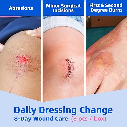 Miniatura 3 de Apósito de espuma de silicona Lite de 3 x 3 pulgadas, borde suave, vendajes impermeables grandes para quemaduras, abrasiones, heridas quirúrgicas,
