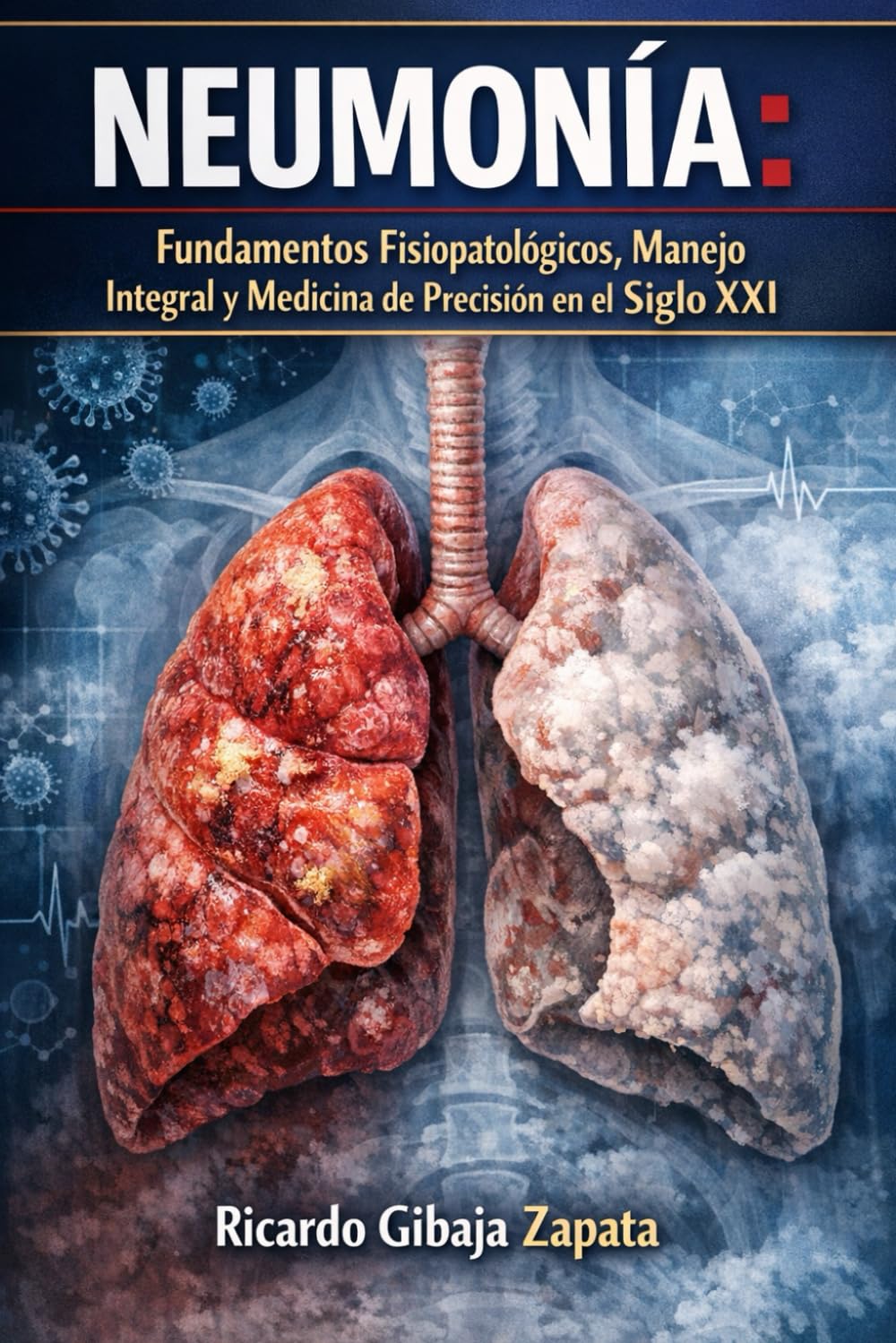 Tratado Integral de Neumonía: Microbiología, Inmunología, Soporte Crítico y Estrategias de Precisión
