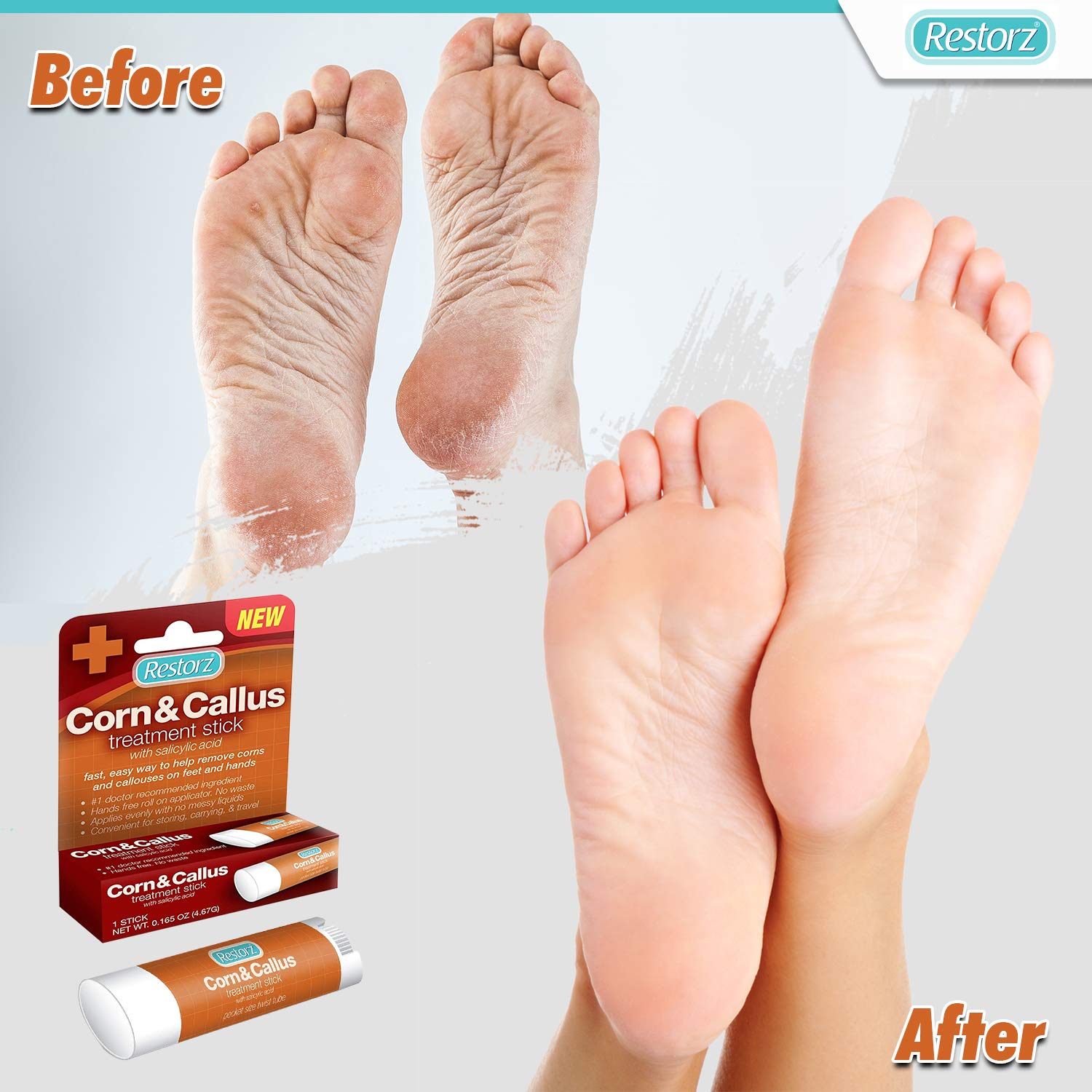 Restorz Corn and Callus Remover with Salicylic Acid, Fast Acting