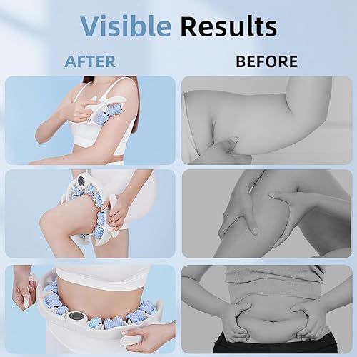 Miniatura 5 de Rodillo de masaje contra la celulitis para piernas, herramienta de masaje anticelulítica con desmontable, removedor de grasas para piernas, muslos,