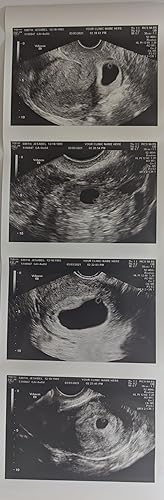 Prank 2D Customized Fake Ultrasound Strip of 4 Photos