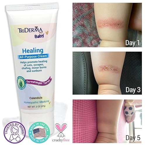 Miniatura 3 de TriDerma Crema curativa multiusos para bebés, elegible por FSA para rozaduras, rasguños, erupciones cutáneas, piel seca, funciona como un ungüento