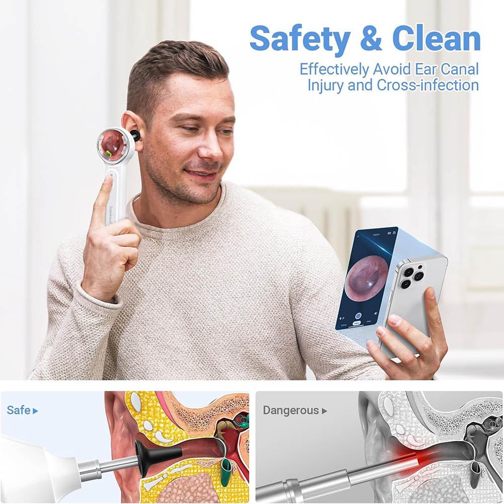 1,85 Pouces IPS Screen Otoscope Numérique, 720p HD Ear Removal Tool Camera, Otoscope avec Lumière, Caméra D'Oreille Vidéo