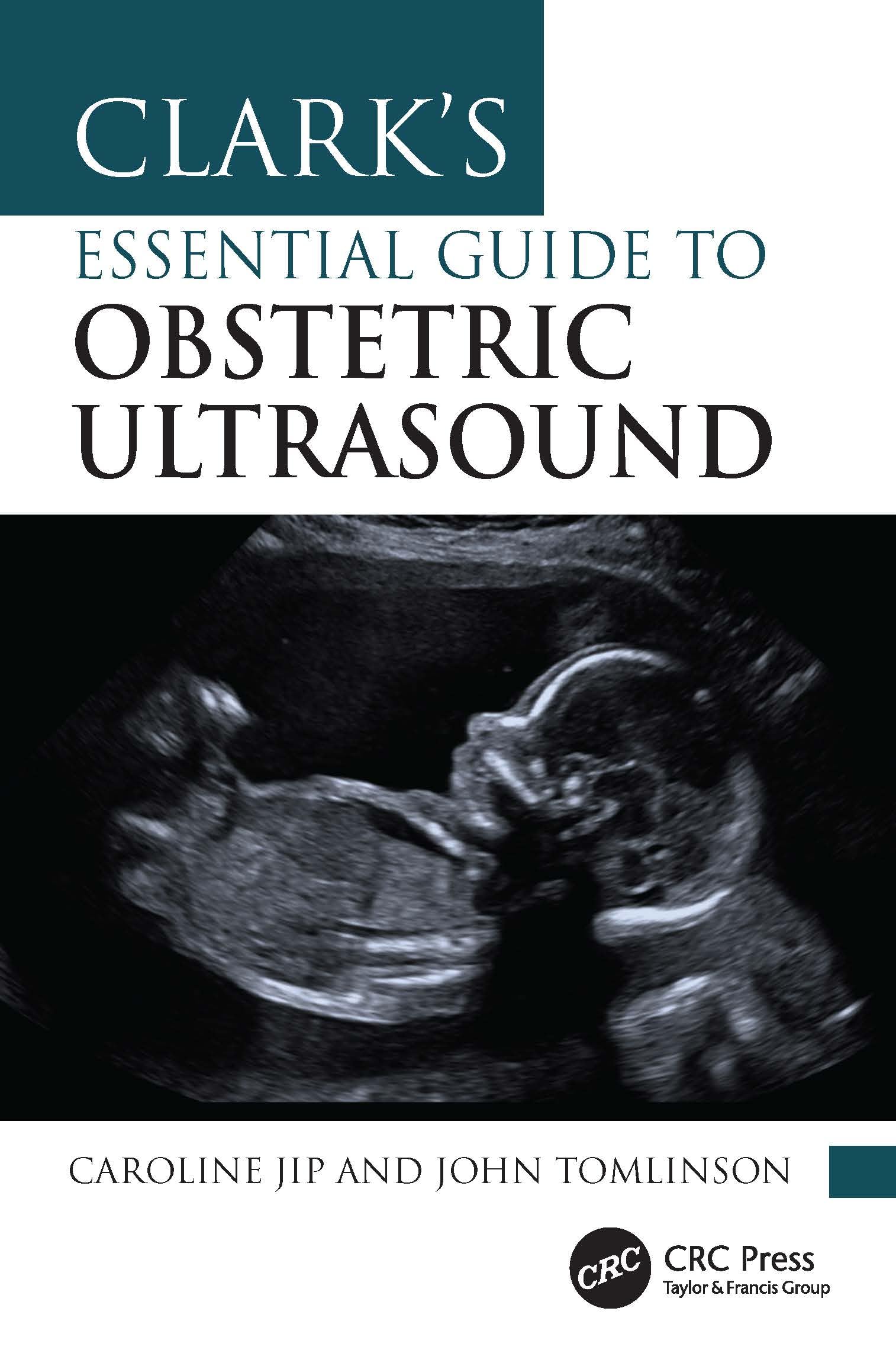 Clark's Essential Guide to Obstetric Ultrasound (Clark's Companion Essential Guides)