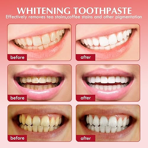 Miniatura 8 de PATO Sp-6 - Juego de pasta dental blanqueadora probiótica, limpieza profunda, eliminación de manchas, protección dental y aliento fresco, sabor