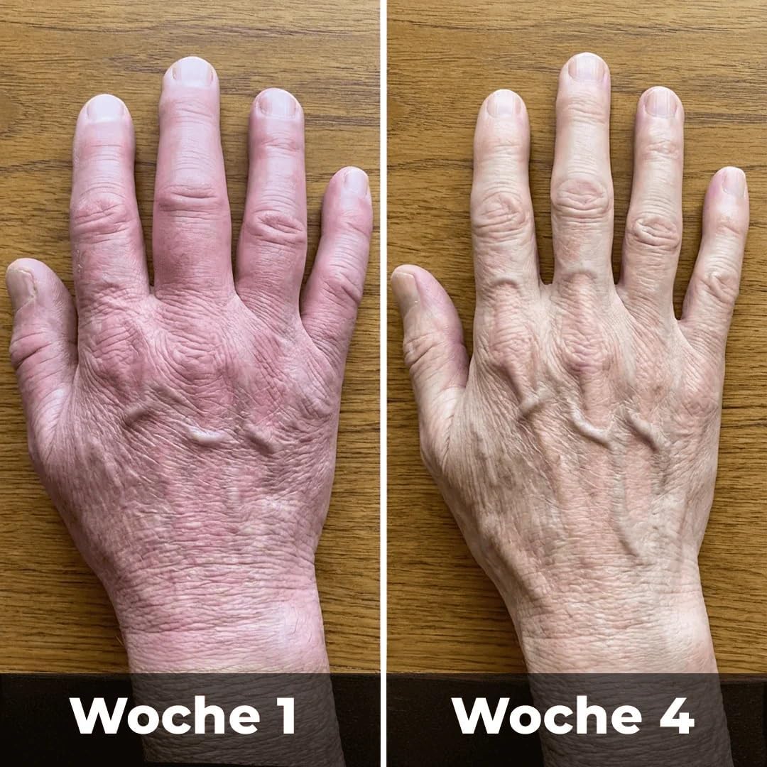 Generisch Neroo Flow Karpaltunnel, Handgelenkband gegen Karpaltunnel, Arthritis, Tendinitis - 5