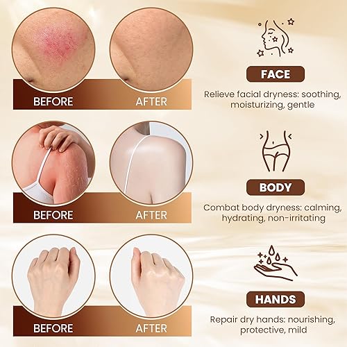 Miniatura 6 de Tallow de ternera para la piel, 100% orgánico alimentado con pasto de ternera con miel cruda - Crema hidratante para cara y cuerpo, cuidado de la