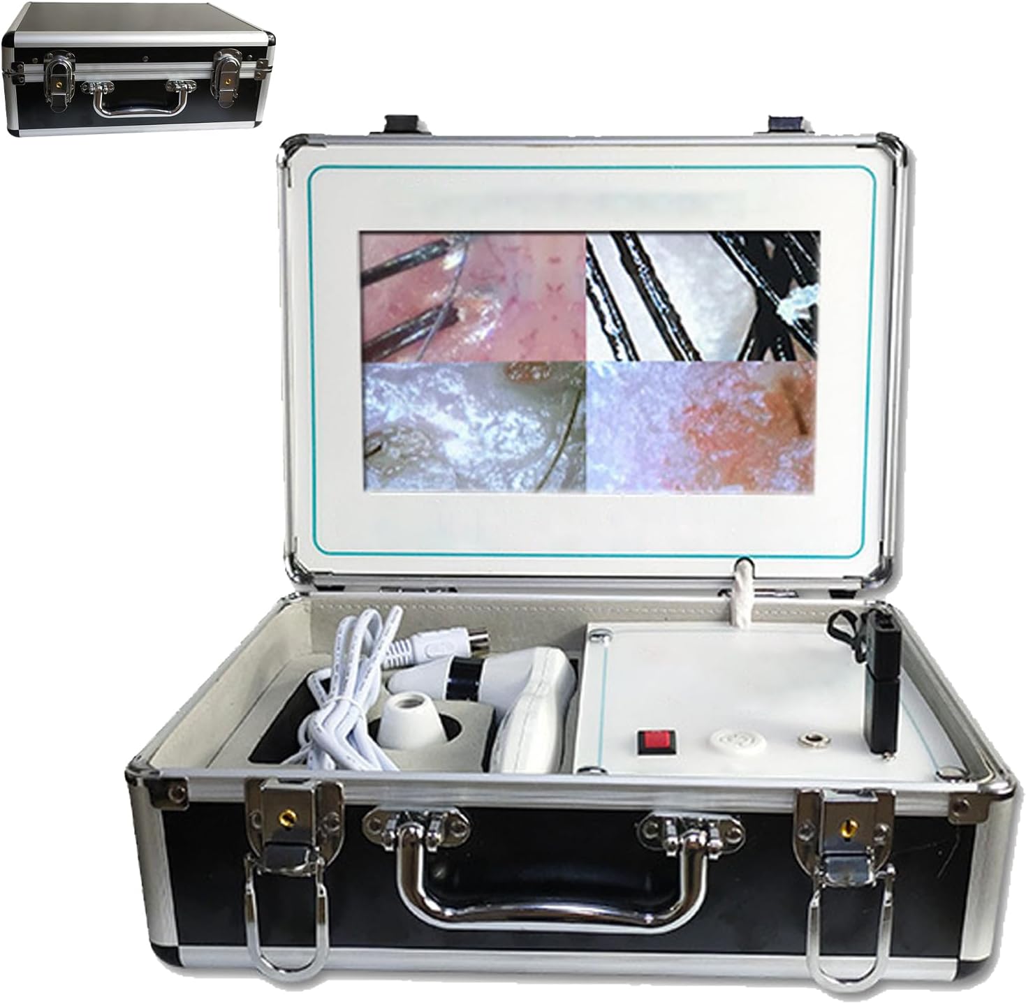 10 Inch Skin Diagnosis Hair Analyzer, Five Spectrum Skin Detector, with 70X 200X Two Probe Follicle Hair Camera, for Home, Salon, Beauty Salon,Rechargeable