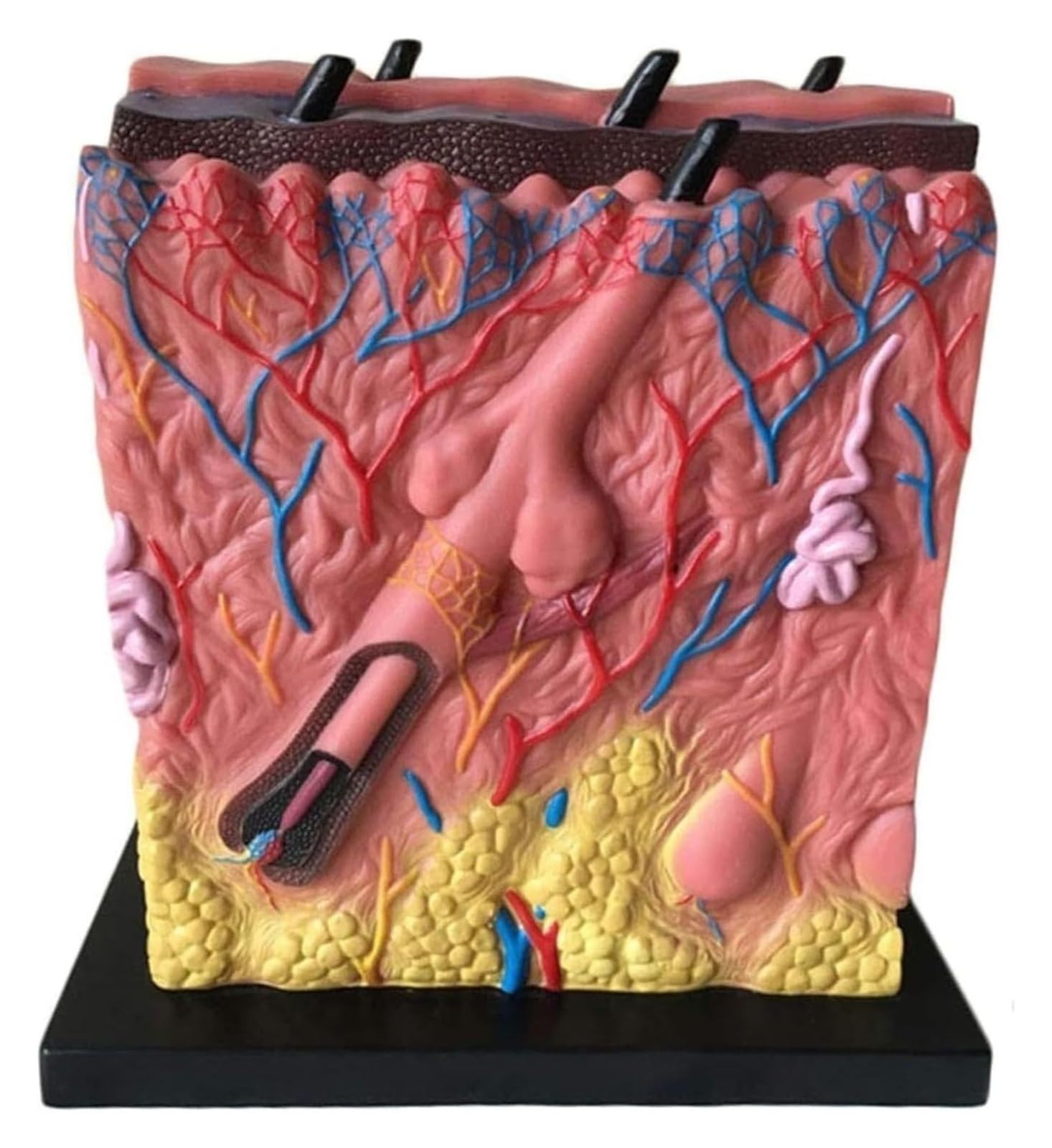 Model skóry trądzikowej, model anatomii skóry ludzkiej, anatomia naskórka z trądzikiem 80X, anatomia skóry właściwej, skóry i tłuszczu, odpowiedni do studiów medycznych, medyczne zasoby edukacyjne
