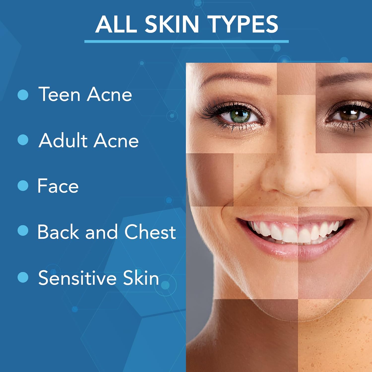 NOVEHA Facial Cleanser For Acne - Hypochlorous Acid Spray - Irritation, Redness & Breakouts Relief - Ideal for Active Teenage & Adult Athletes Post-Workout - Safe for Multiple Daily Uses - 8 oz - Image 4