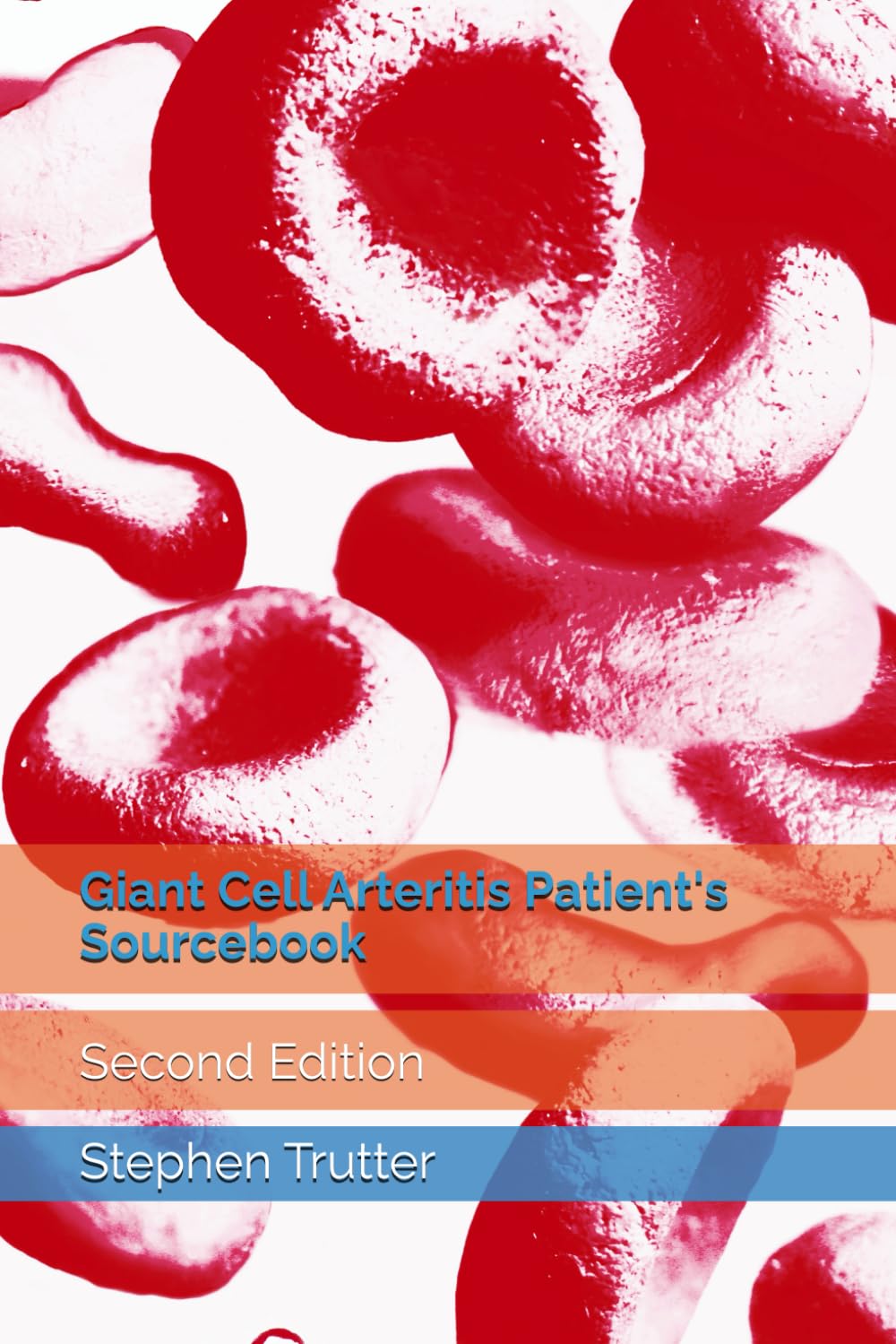 Giant Cell Arteritis Patient's Sourcebook: Second Edition
