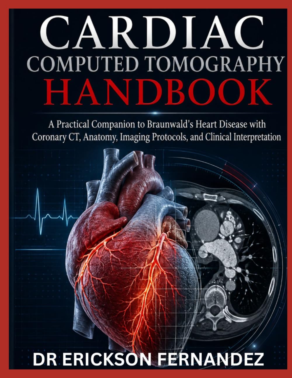 CARDIAC COMPUTED TOMOGRAPHY HANDBOOK: A Practical Companion to Braunwald's Heart Disease with Coronary CT, Anatomy, Imaging Protocols, and Clinical Interpretation