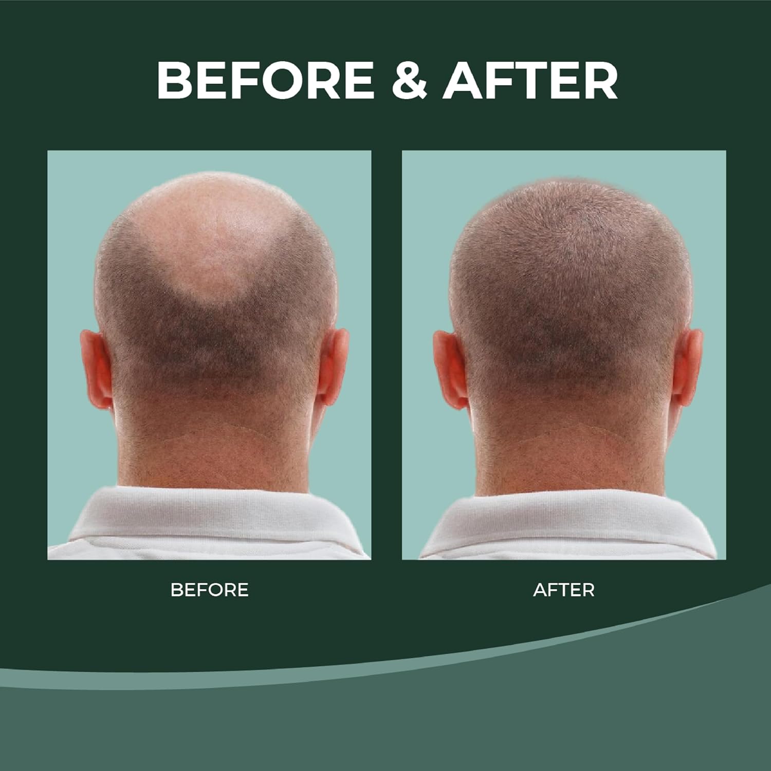 Thik&Fix Hair Growth Latest for Men: Thickener & Hair Loss Solution with Spray and Shampoo for Fuller Hair