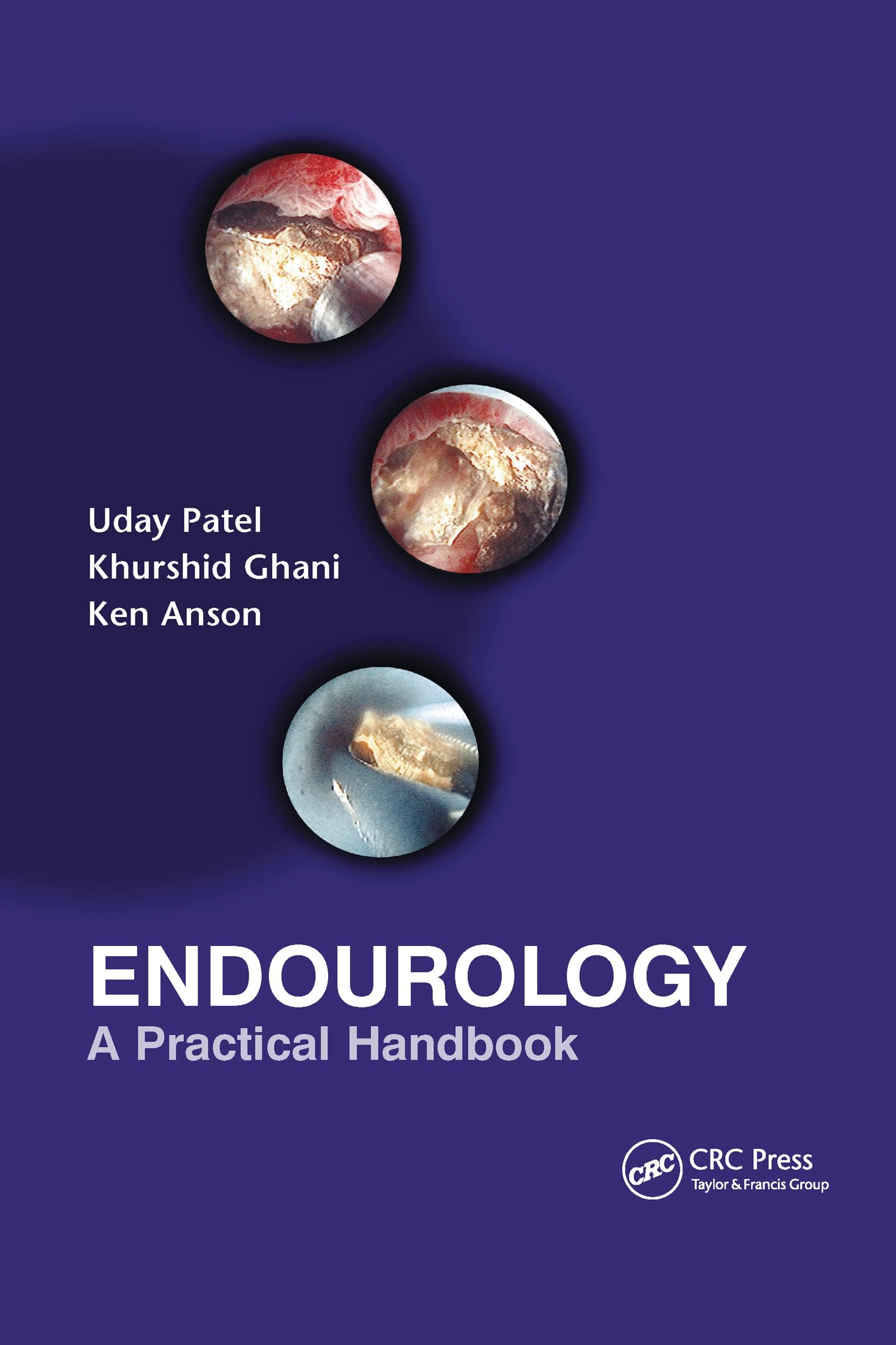 Endourology 1st Edition