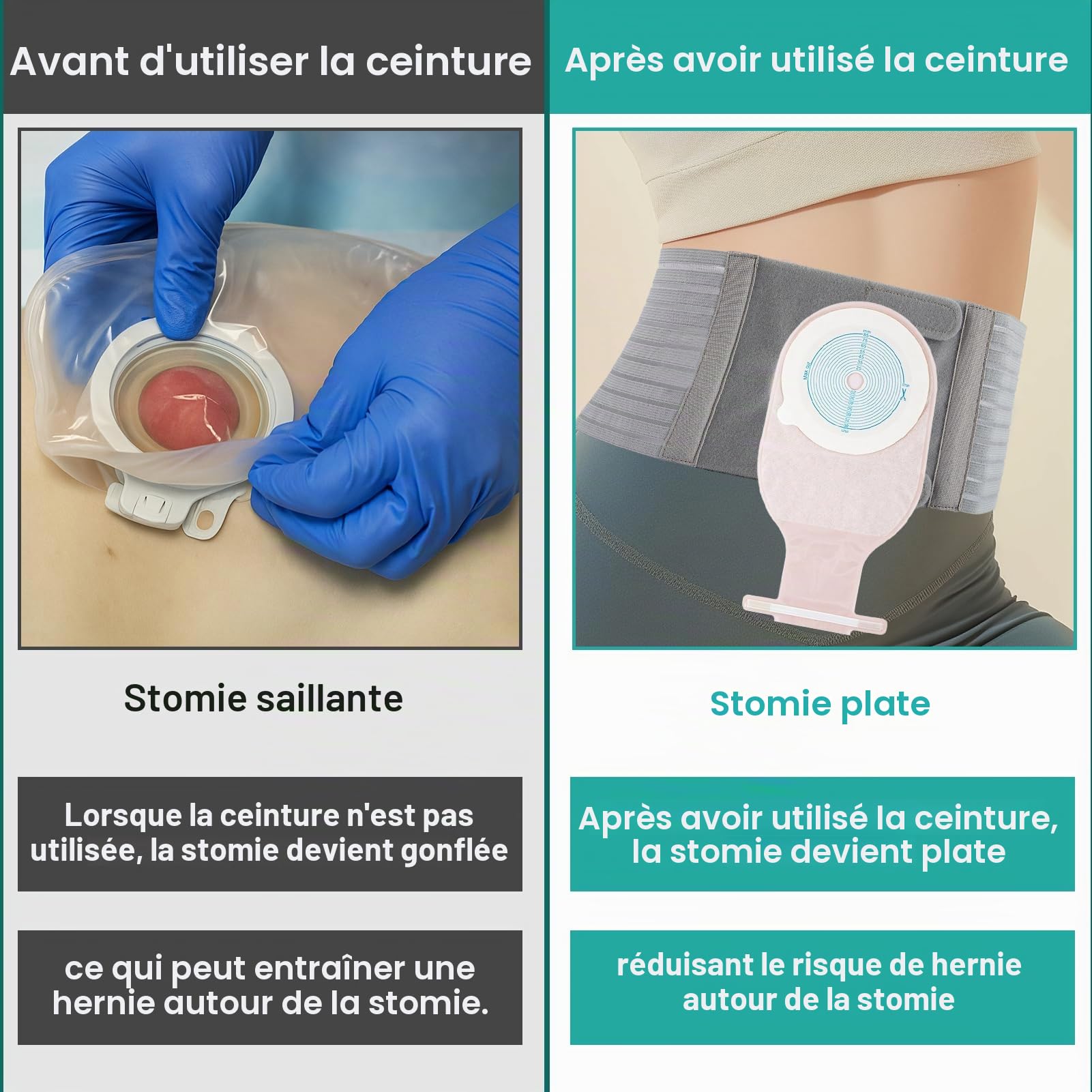 1 PCS Ceinture De Stomie Pour Homme & Femme, Ostomy Belt Gris Foncé de 13 cm de Large, Ceinture De Maintien Pour Le Soutien De Sac De Colostomie Prévenir Hernie Parastomal, M | Bandage de stomie réglable, universel, protection de ceinture de colostomie, a