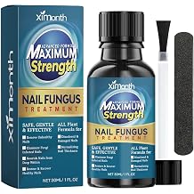 Effective Antifungal Nails Treatments, Fungal Nail Treatment for Toenails Extra Strong, Nail Fungus Treatment for Toenail, Strengthen and Revitalize Damaged, Broken, Discolored Nails, 30ML A+++