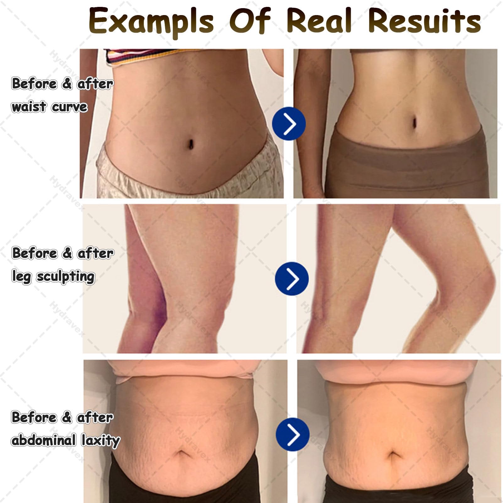 Apparecchio professionale per terapia a radiofrequenza, per sollevamento RF, perdita di peso e modellamento del corpo, con 3 maniglie e 8 postazioni di lavoro per trattamenti fisici profondi Black