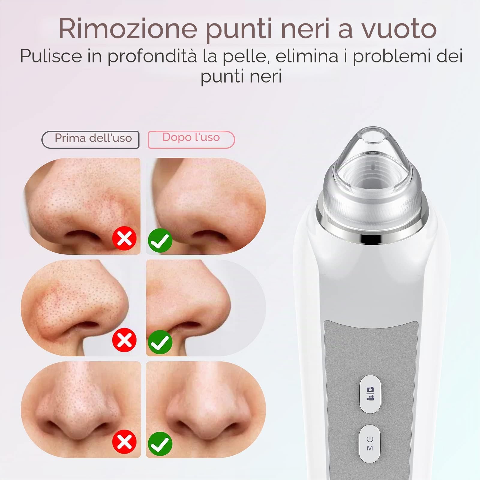 Aspirapolvere per la rimozione dei punti neri, per viso con fotocamera, aspirapolvere per pori per uomini e donne, strumenti di rimozione dei punti neri, 6 testine di aspirazione e 3 modalità di