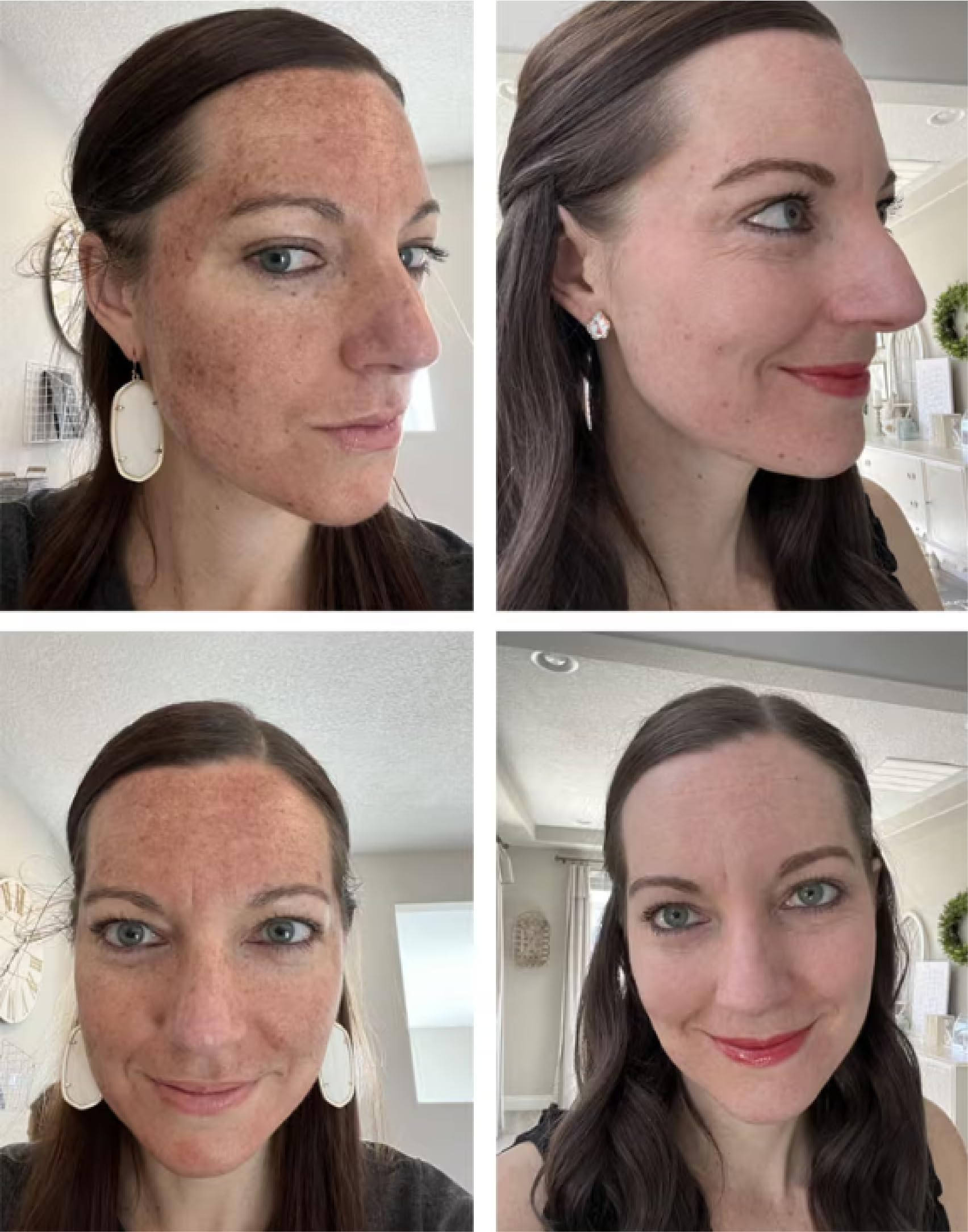TCATherapyCare Solution Acid Peel 90% (Livello 2 pH 1.9) - Esfoliante, texture e tono della pelle - peeling viso - 30 ml