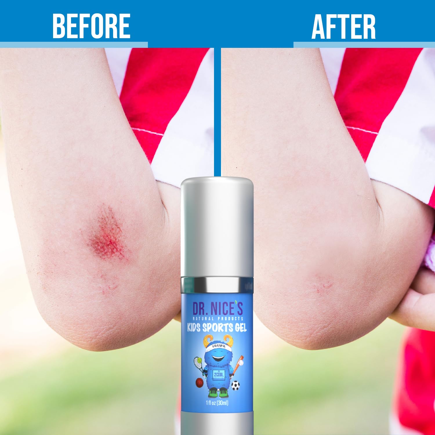 DR. NICE'S Kids Sports Hydrogel for Blister Care, Chafed Skin Relief, Scrapes, Minor Cuts, Wounds, Burns - Soothing Cooling First Aid Gel for Raw & Irritated Skin - Natural, Made in USA - 30 ML — Amazon image 5