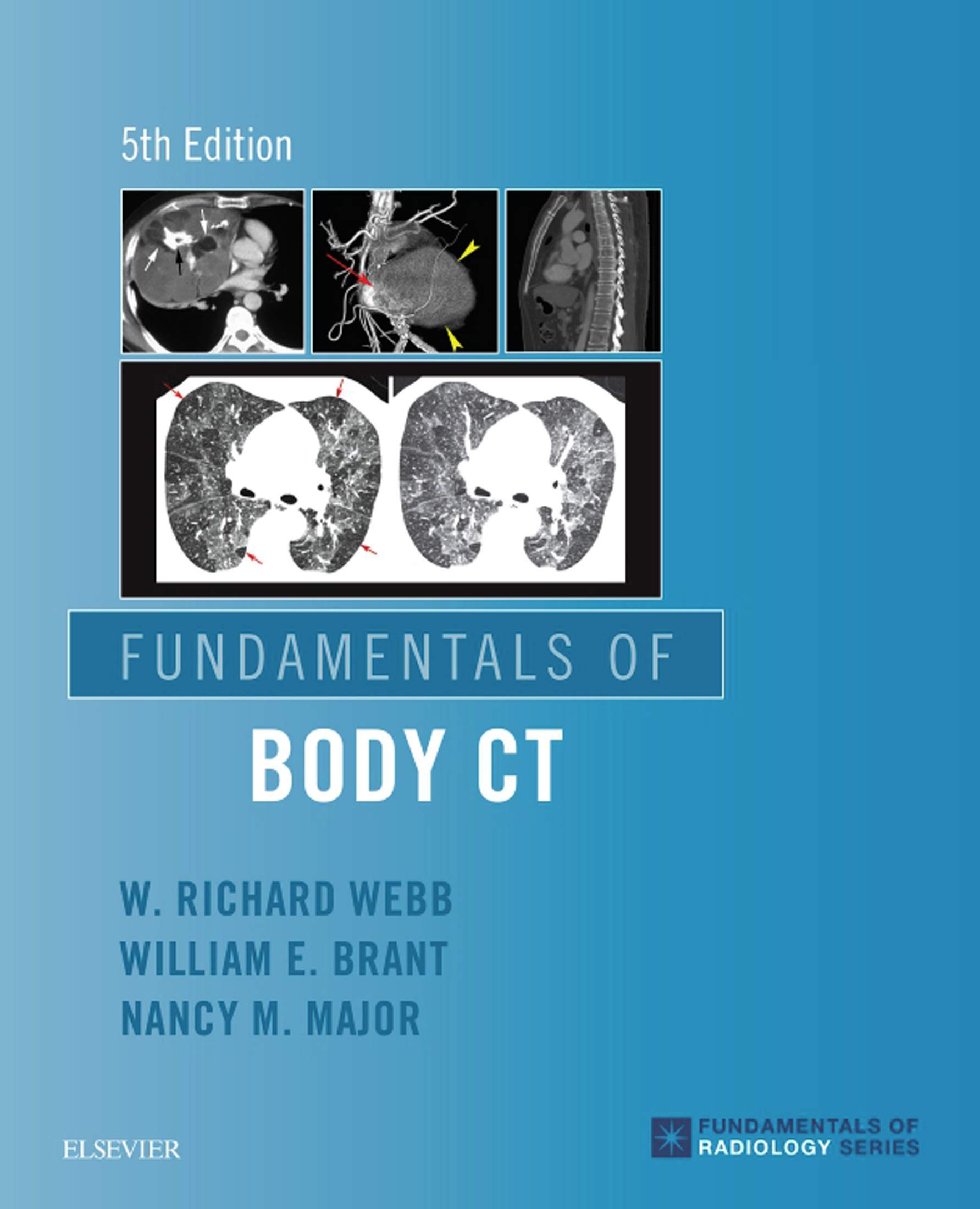 Fundamentals of Body CT E-Book (Fundamentals of Radiology)