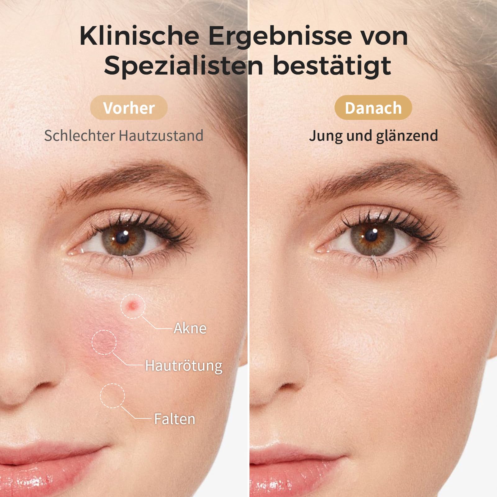 Auxoliev LED-Gesichtsmaske mit Lichttherapie, kabellos, 850 nm 633 nm 415 nm (Rot, Blau, Nahinfrarot), zur Reduzierung von Falten und feinen Linien – für die Hautpflege zu Hause