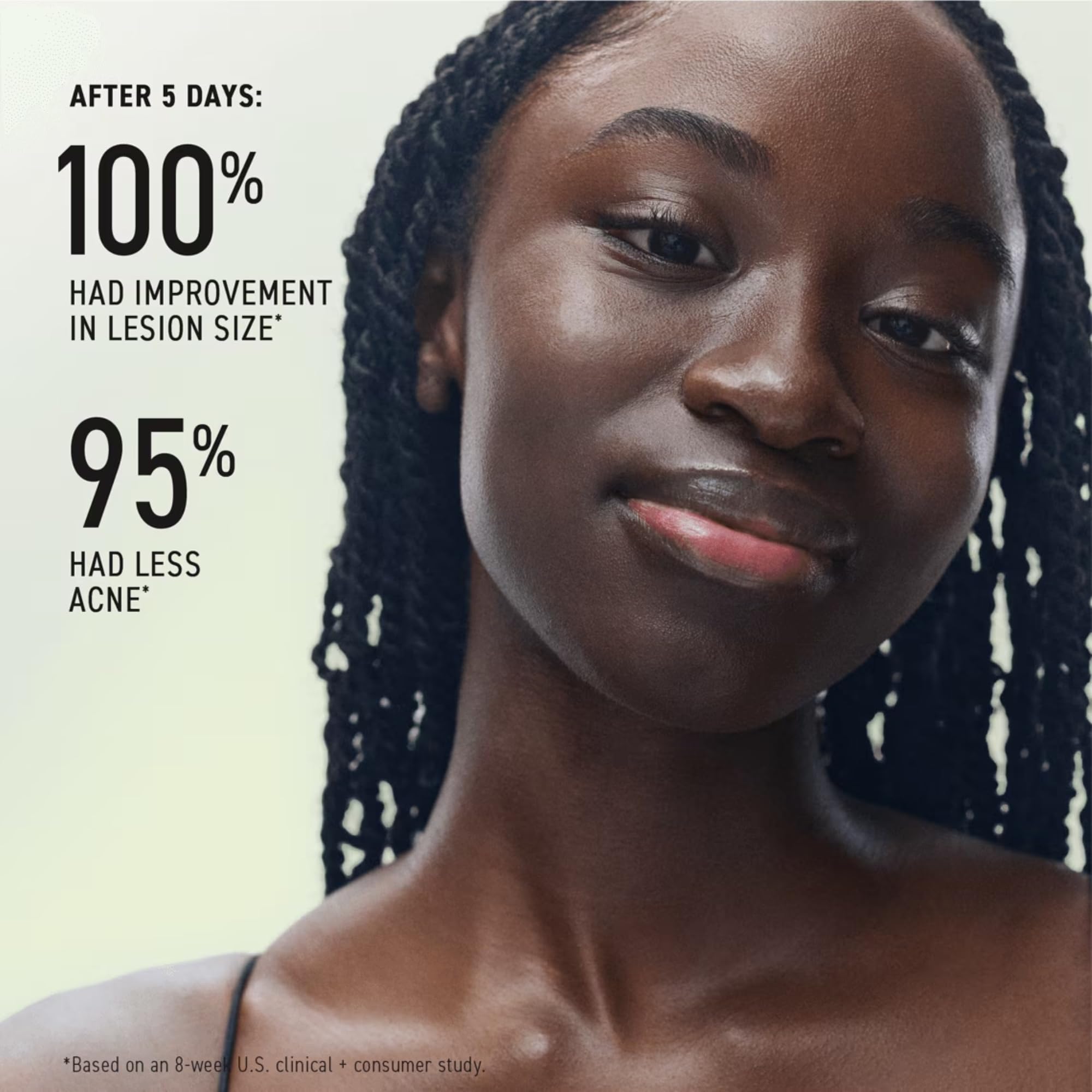 Rodan + Fields Spotless Acne Care Regimen with Benzoyl Peroxide