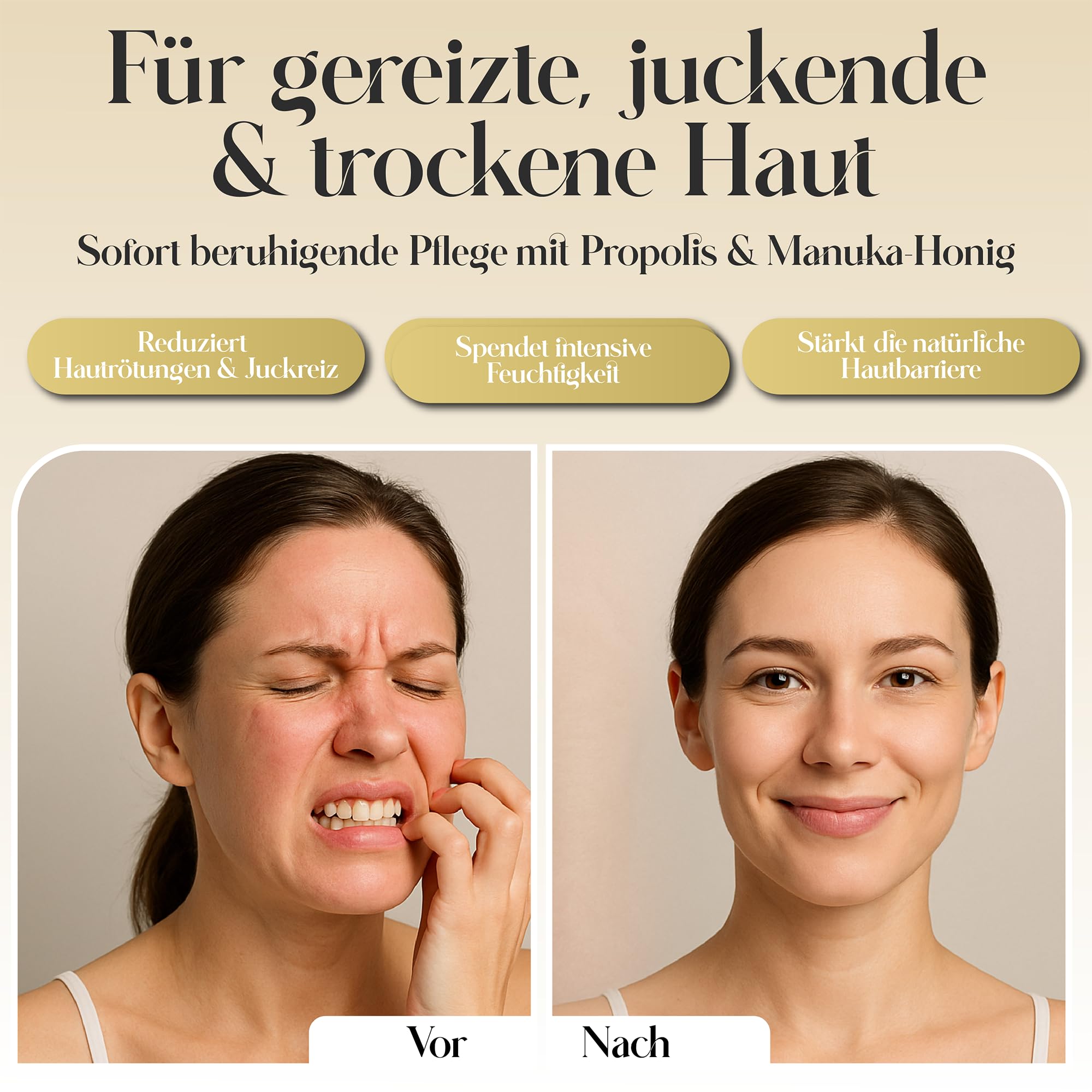 Ungüento de propóleo orgánico – 16 Secreto farmacéutico con propóleo orgánico, miel de manuka y cáñamo – Cuidado calmante para pieles secas e irritadas – Dermatológicamente recomendado