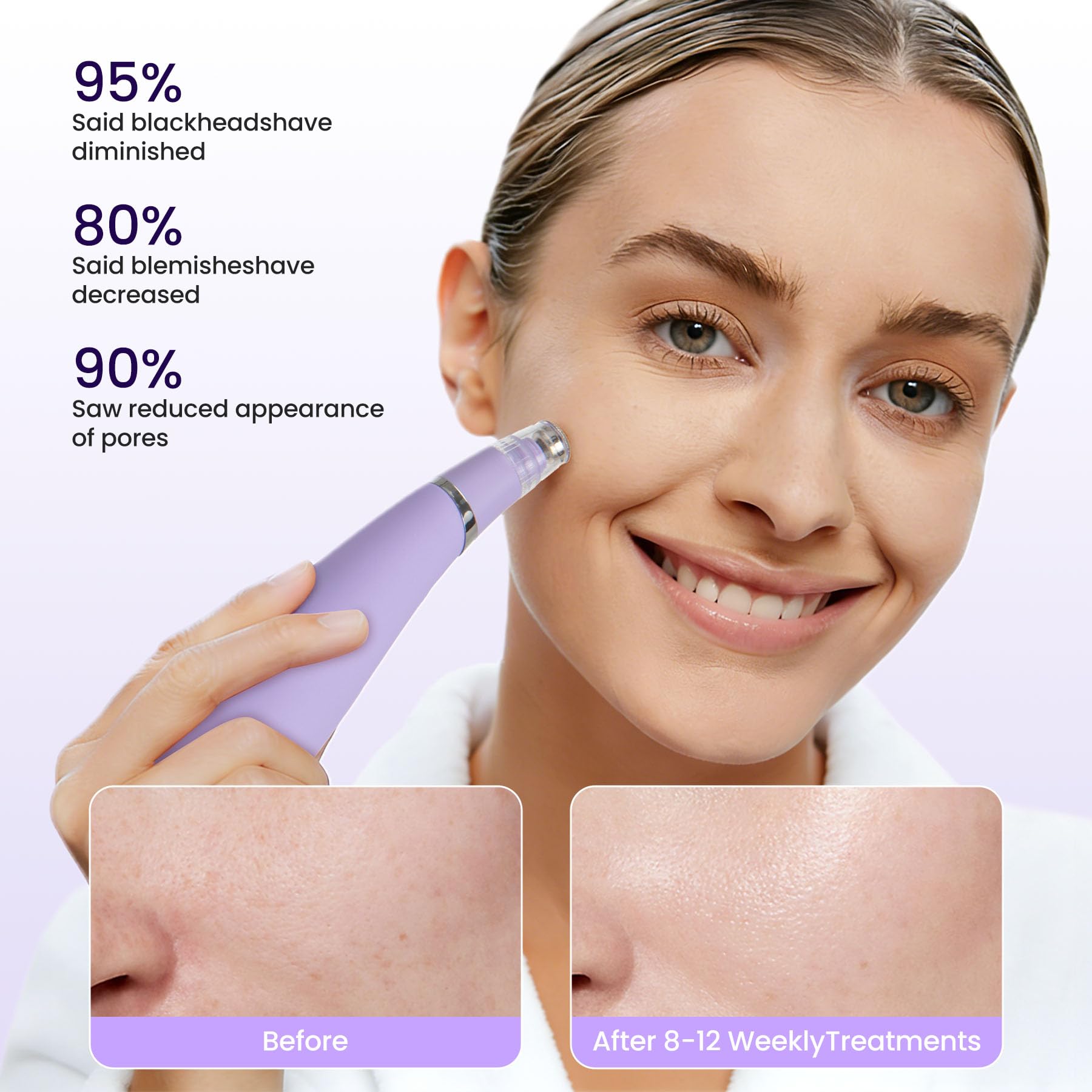 UNOISETION Máquina de microdermoabrasión de diamante, 4 modos de microdermoabrasión de diamante, 2 puntas de diamante, 3 cabezales, removedor de manchas de puntos negros (morado)
