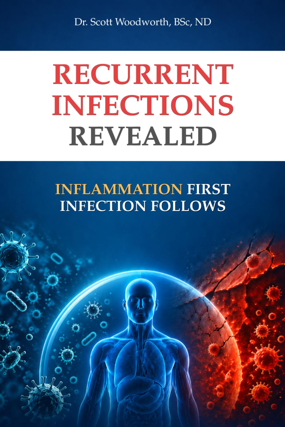 Recurrent Infections Revealed: Inflammation Comes First. Infections Follow: 11 (Chronic Inflammation and your Diet)