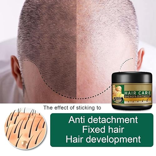 Miniatura 2 de Pomada para el crecimiento del cabello de jengibre, crema de crecimiento del cabello de jengibre para la pérdida del cabello y adelgazamiento del