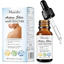 Skin Mole Remover for Hands & Body