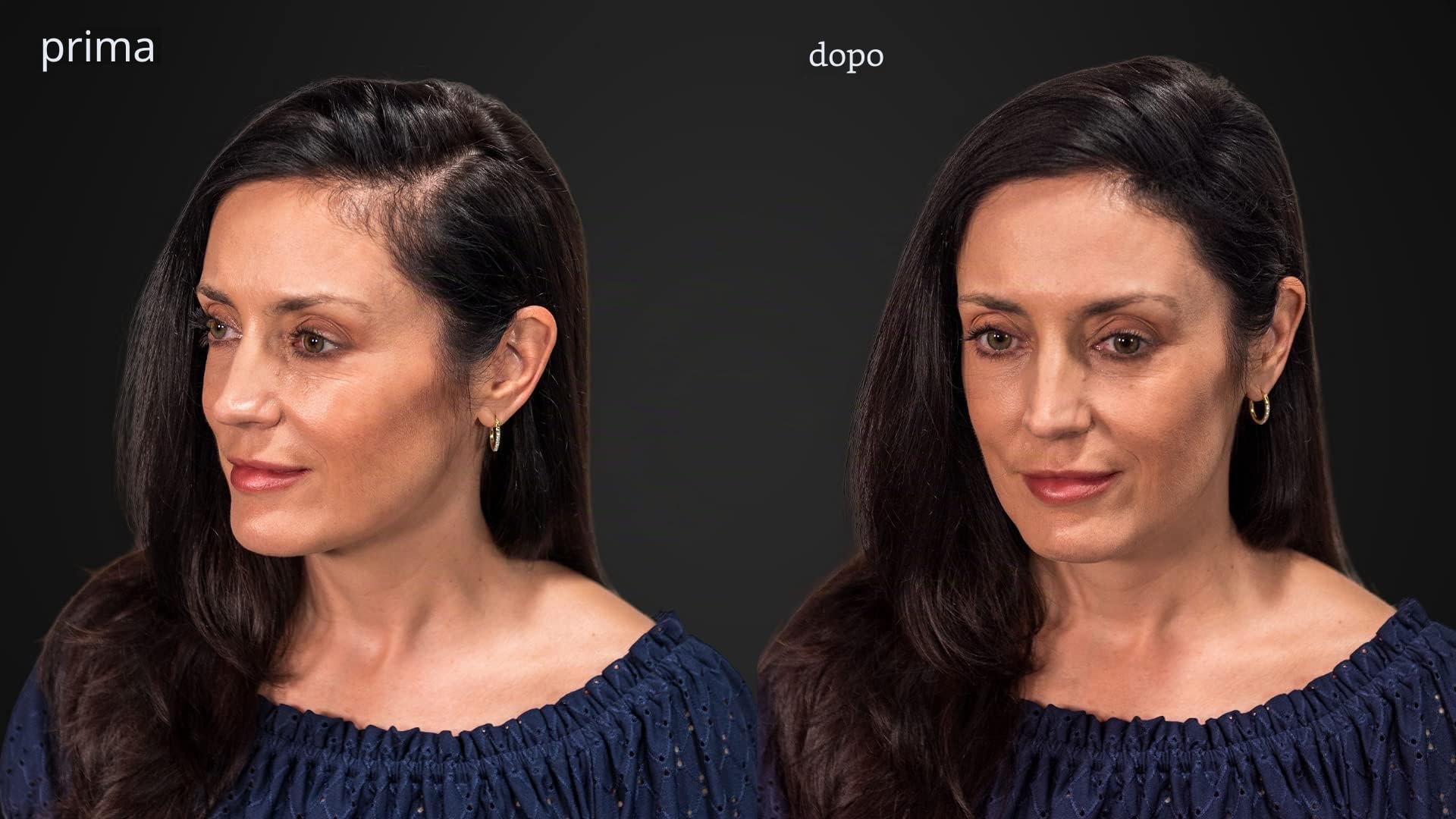 LUXE Fibre ispessimento capelli con cheratina naturale - Dura 2 mesi! - Testato da dermatologi – Ipoallergenico - Molteplici colori disponibili. Castano scuro